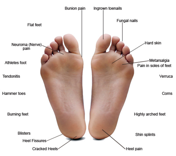 Foot Conditions