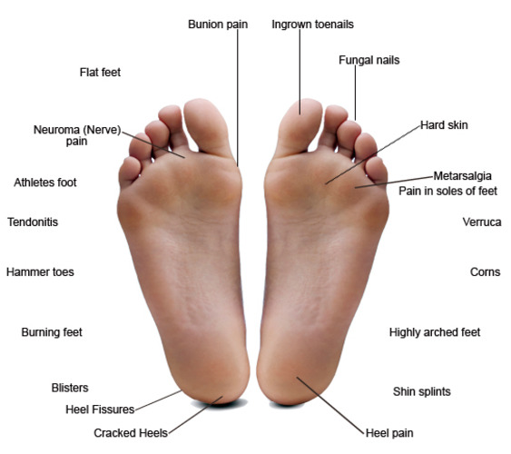 Foot Orthotics Vancouver